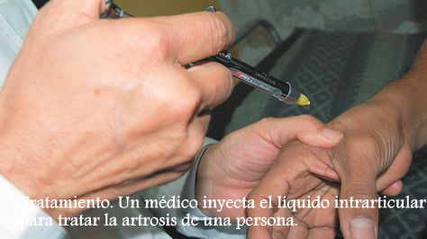 tratamiento-liquido-intrarticular-artrosis-persona_lrzima20120911_0003_3.jpg